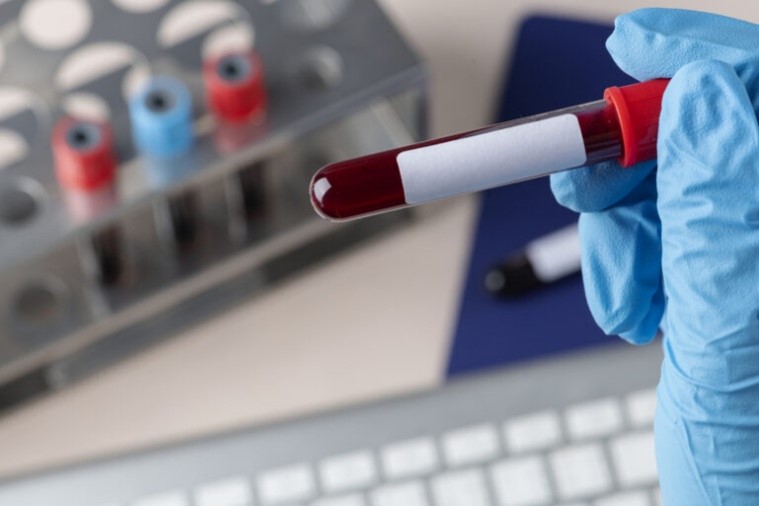 COLETA DE SANGUE DO EMPREGADO SEM AUTORIZAÇÃO VIOLA INTEGRIDADE FÍSICA